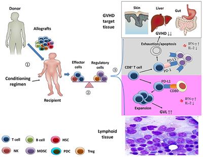 Strategies for Enhancing and Preserving Anti-leukemia Effects Without Aggravating Graft-Versus-Host Disease